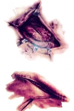 Tijdelijke Tattoo van Bloederige Wonden